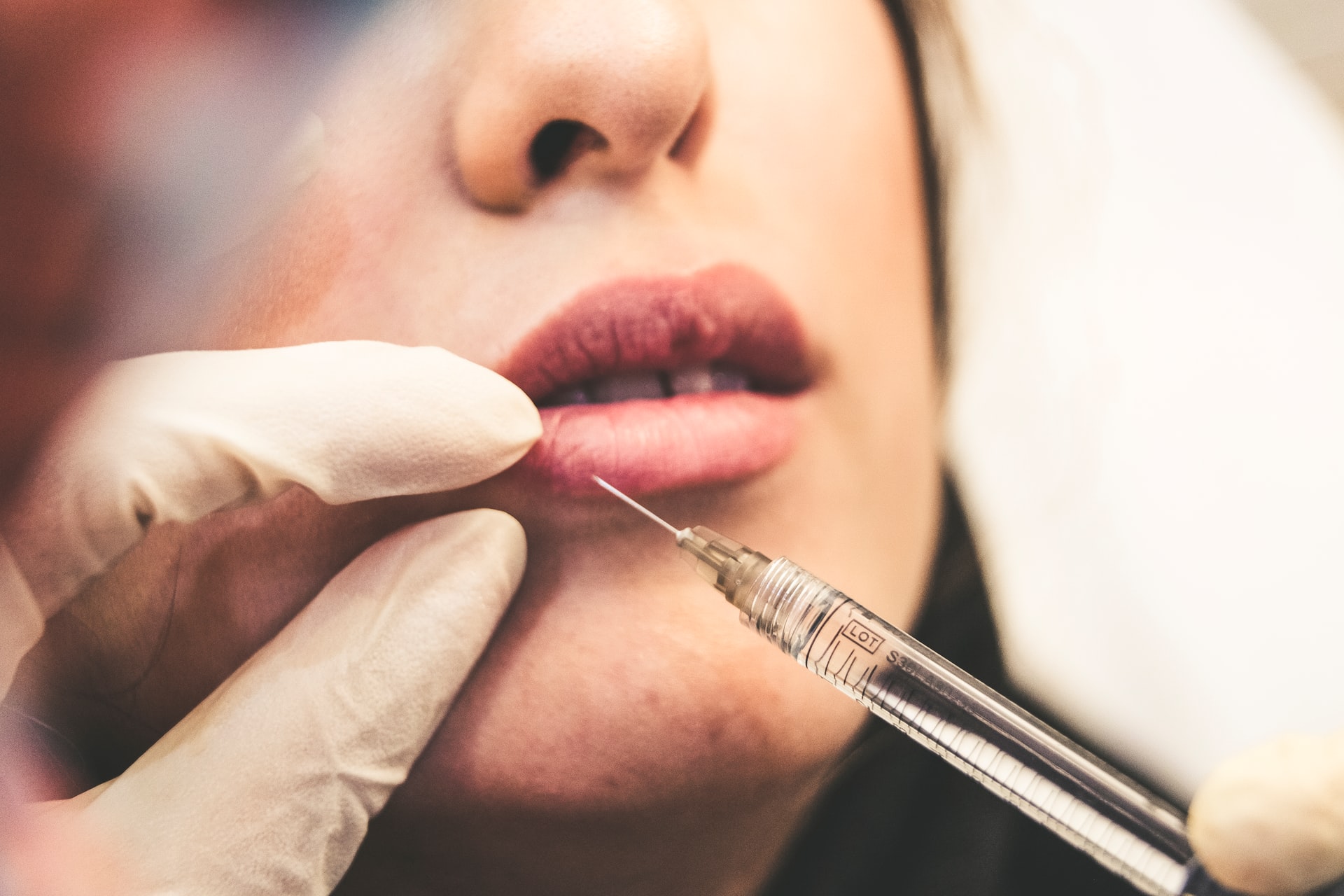 woman getting lip fillers